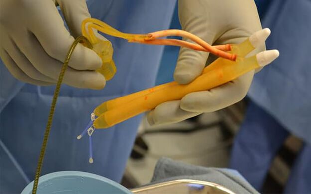 Penis implanted